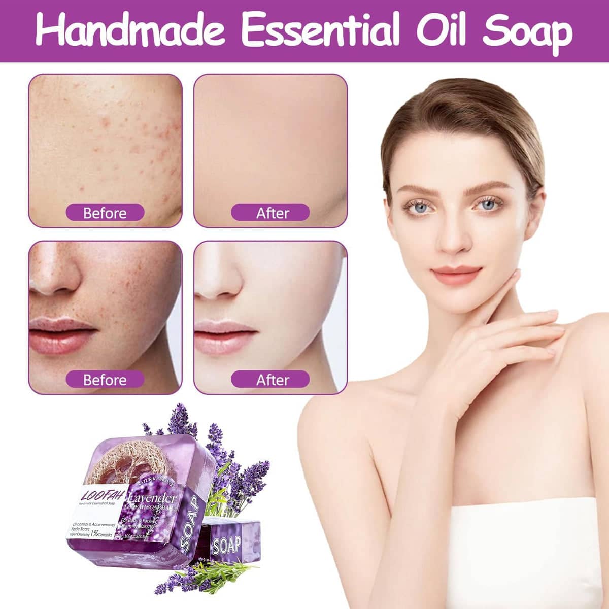 5 Pack Loofah Essential Oil Soap Bars Facial Cleansing Exfoliating - Aloe - view 5