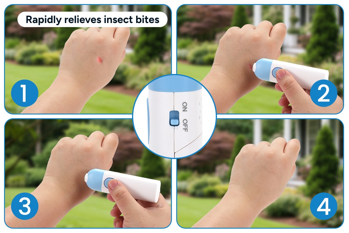 Insect Bite and Itch Healer