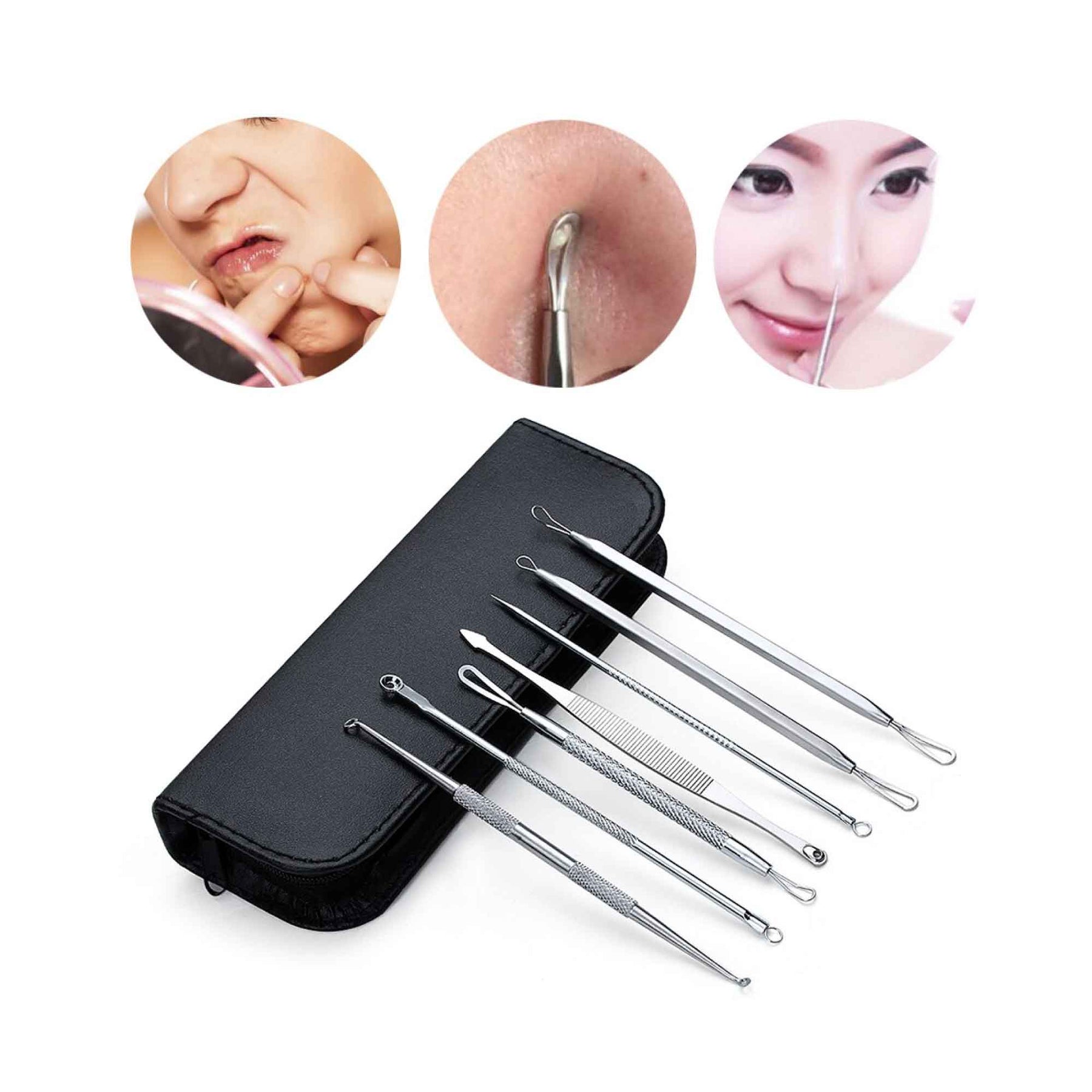 Blackhead Remover 7 Piece Tool Kit For Pimple Extraction Blemish Suction Removal - SuperSaverAU - view 2