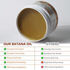 Hualijia Batana Oil 120ml - Scalp & Hair Oil for Growth, Repair & Moisture - SuperSaverAU - view 3