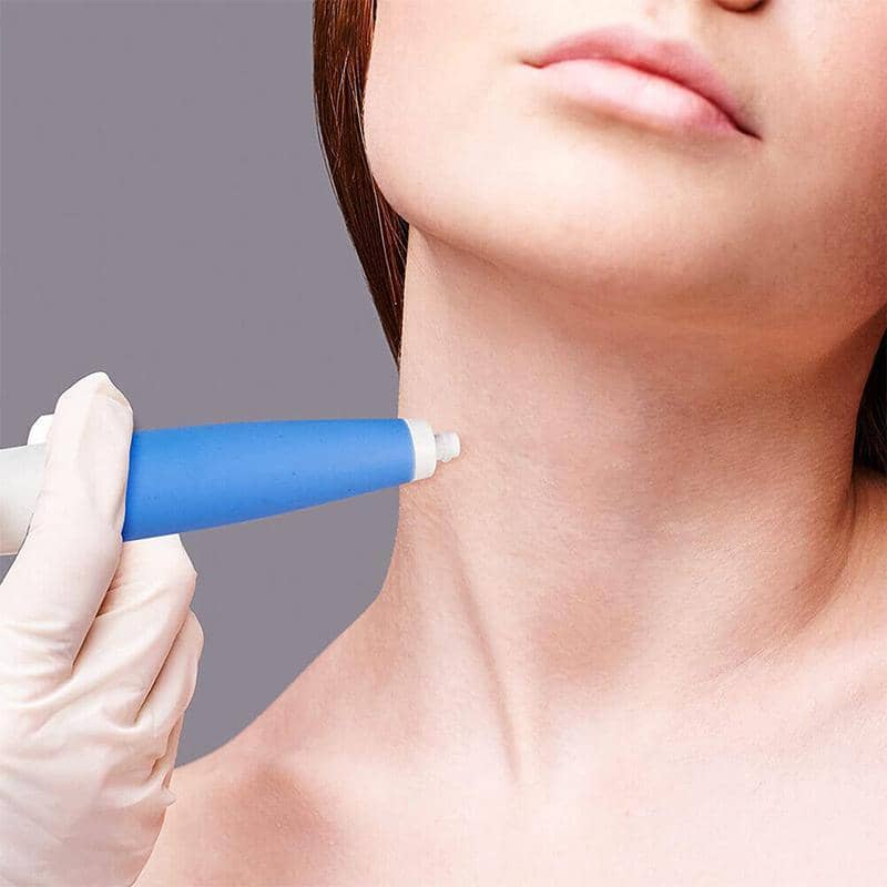 Auto Skin Tag Remover Kit with Bands and Band Loader - view 4