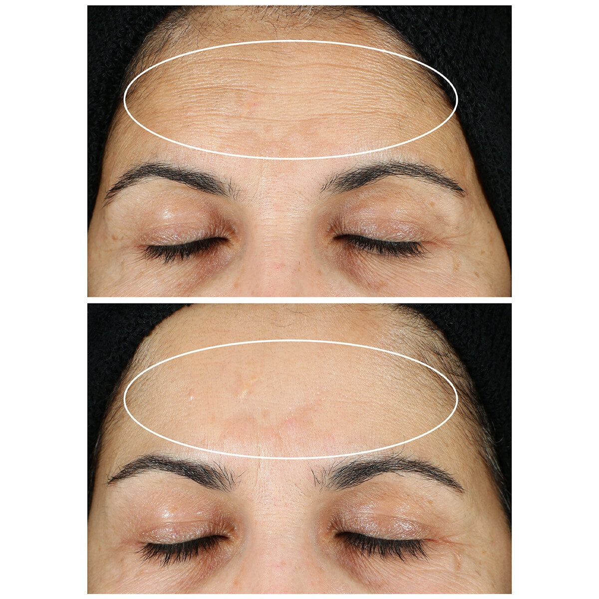 StriVectin Super-C Retinol Brighten And Correct Vitamin C Serum - SuperSaverAU - view 3