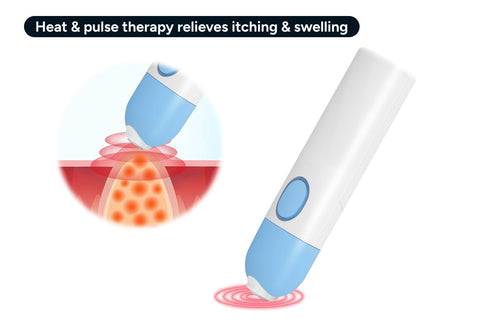 Insect Bite and Itch Healer