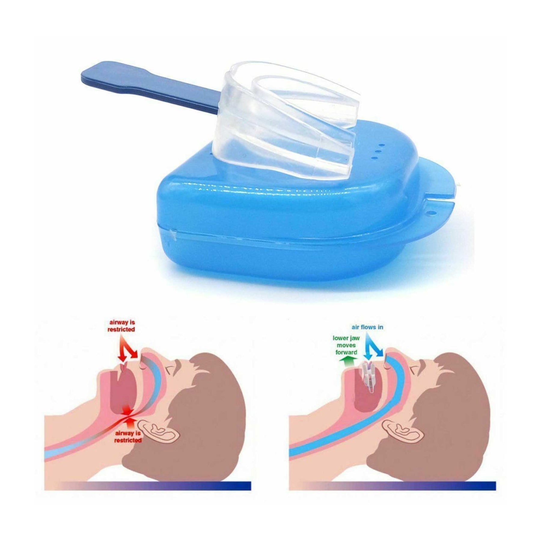 2x Mouthguard Mouthpiece & Nose Clip Soft Silicone Anti Snoring Sleep Breathing Aid - SuperSaverAU - view 7