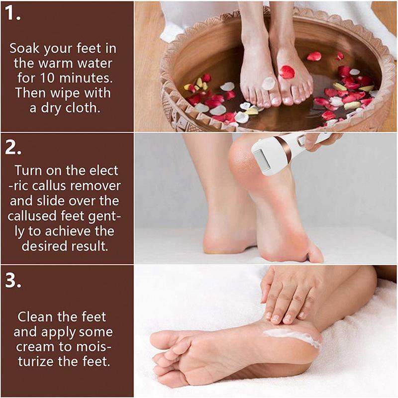 Electric Callus Remover Foot Grinder Kit by Premium - 3 Grinding Units