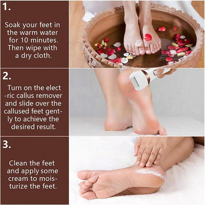 Electric Callus Remover Foot Grinder Kit by Premium - 3 Grinding Units