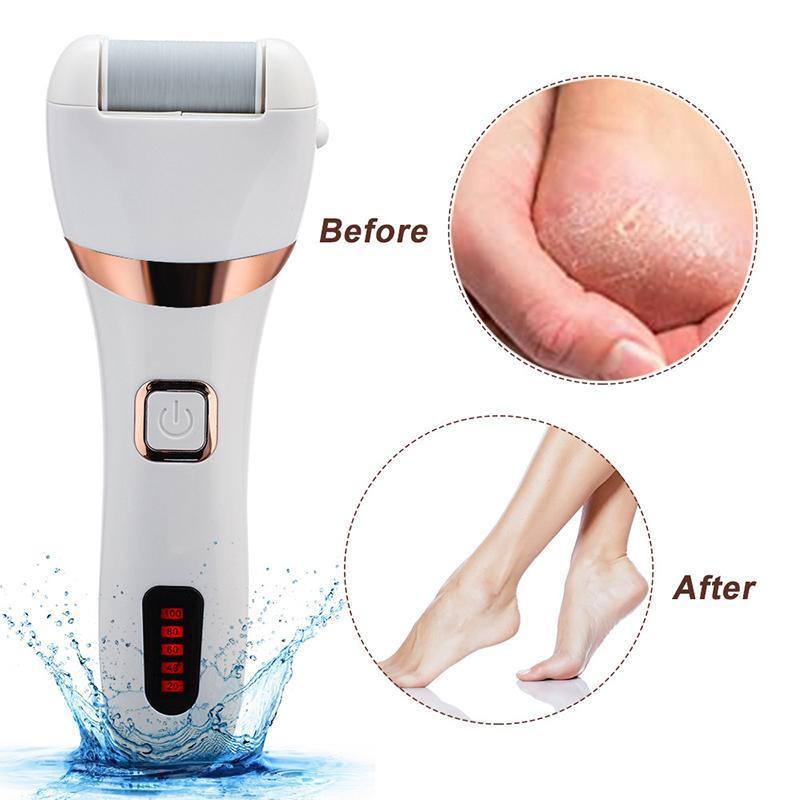 Electric Callus Remover Foot Grinder Kit by Premium - 3 Grinding Units