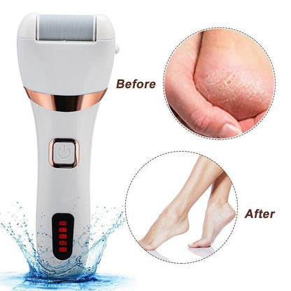 Electric Callus Remover Foot Grinder Kit by Premium - 3 Grinding Units