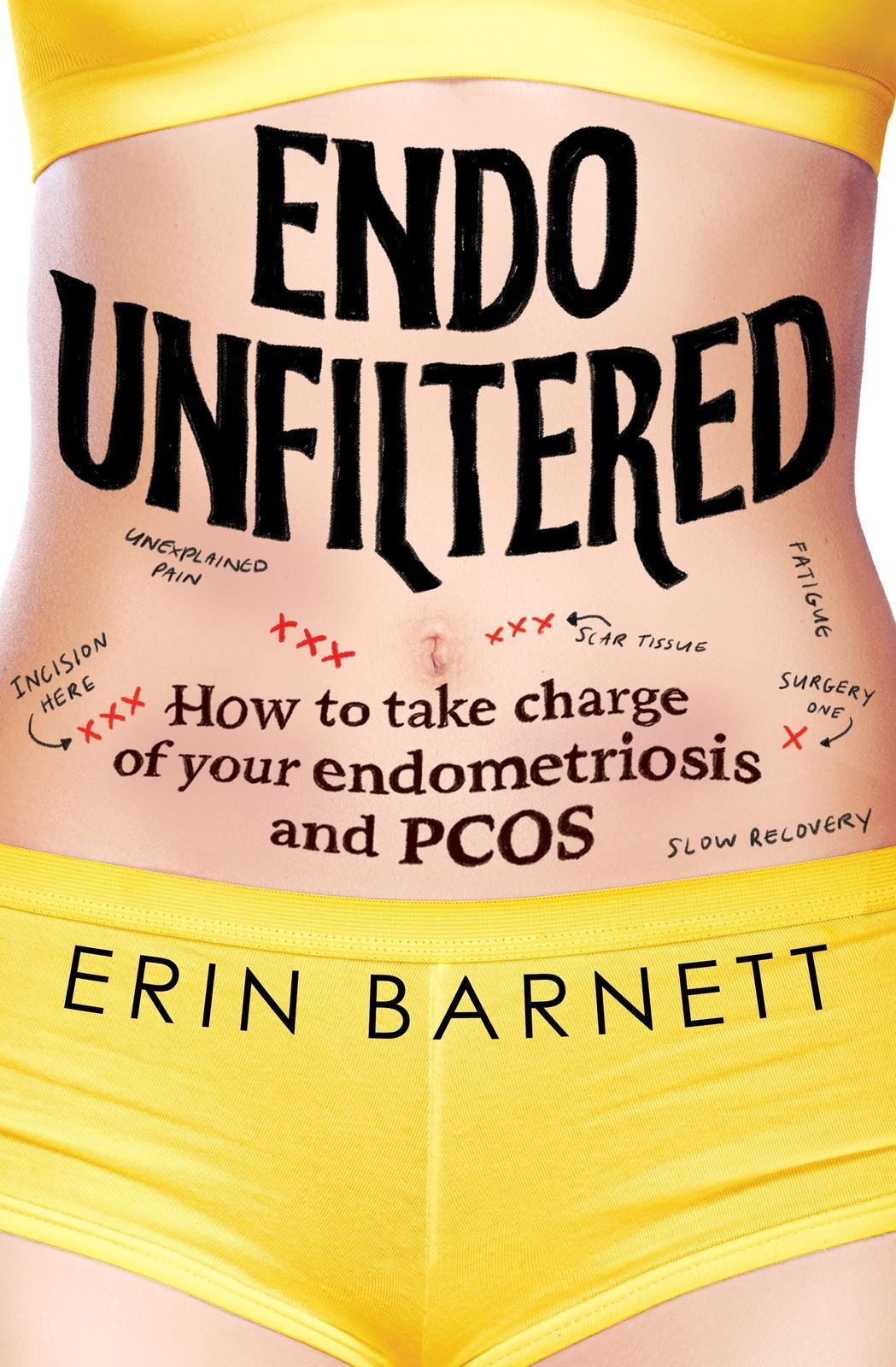Endo Unfiltered: Erin Barnett's Guide to Endometriosis & PCOS, 240 Pages, Paperback