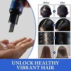 Nifeishi Organic Rosemary Essential Oil 120ml - Stimulates Hair Growth & Revitalises Scalp