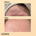COSRX Advanced Snail 96 Mucin Power Essence 100ml Hydrating Korean Skincare