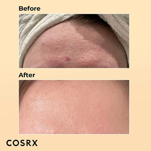 COSRX Advanced Snail 96 Mucin Power Essence 100ml Hydrating Korean Skincare
