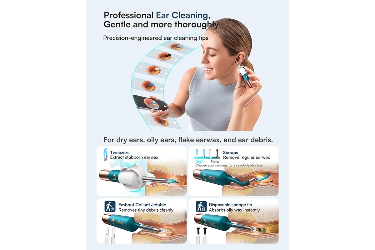 Xiaomi Bebird Earsight Ultra Wireless Ear Cleaner