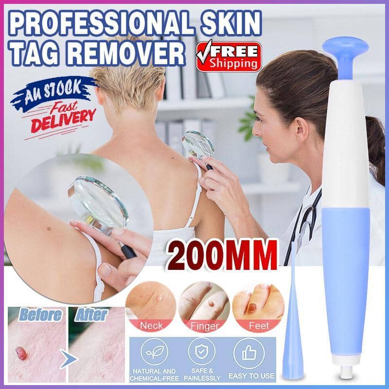 Auto Skin Tag Remover Kit with Bands and Band Loader
