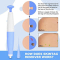 Auto Skin Tag Remover Kit with Bands and Band Loader - view 3