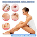 Auto Skin Tag Remover Kit with Bands and Band Loader - view 5