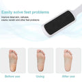 Double Sided Foot File Callus Remover Pedicure Tool for Hard Skin - view 5