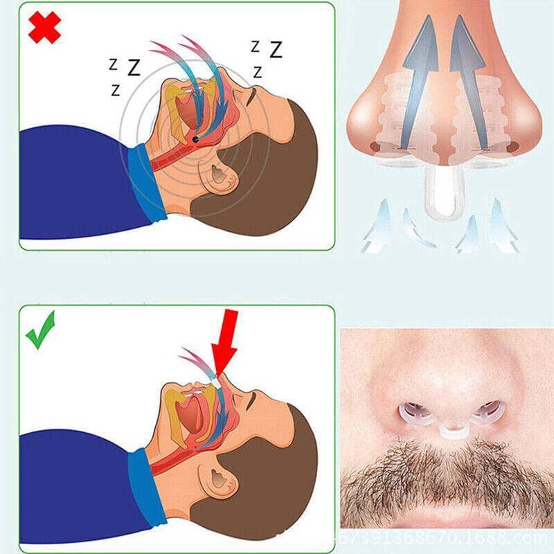 Nasal Vent Clip, Soft Reusable PE Dual-Vent Basket Design - White - view 4