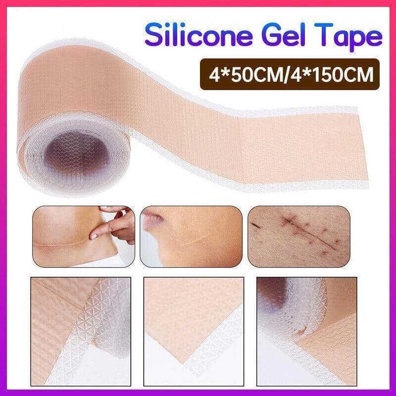 Silicone Gel Scar Tape, Self-Adhesive Patch Roll - 4 x 150 cm - view 2