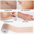Silicone Gel Scar Tape, Self-Adhesive Patch Roll - 4 x 150 cm - view 4