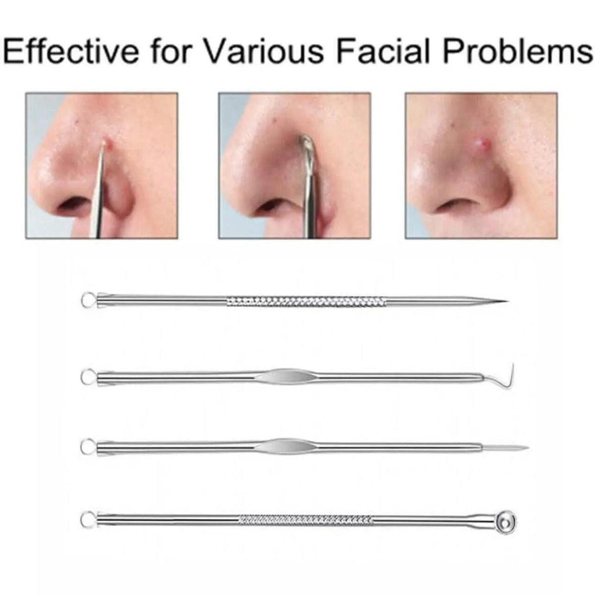 Stainless Steel Blackhead Remover Tool Set 4 Pieces - Gold - view 5