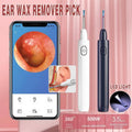 Visual Ear Wax Remover Pick with 5MP Camera and LED Light - Navy Blue - view 2